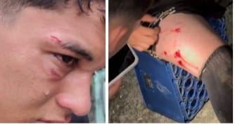 Herido menor de edad tras una tángana en vacacional de fútbol en Barinas